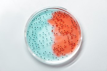 Bacterial working stocks in laboratories