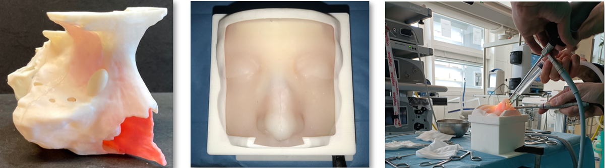 paranasal sinuses surgical training model