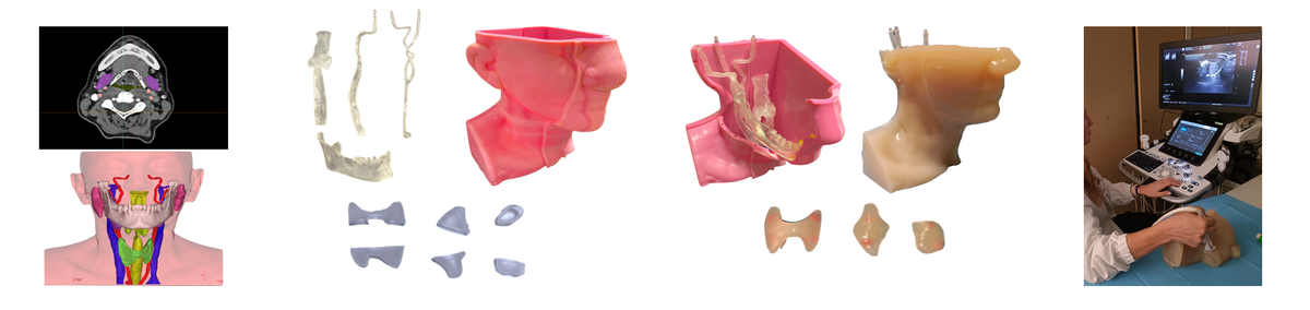 Head and neck US simulator - Realization phases
